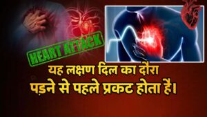 Heart Attack Early Symptoms 